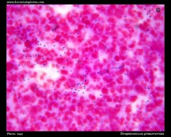 S.pneumoniae in CSF